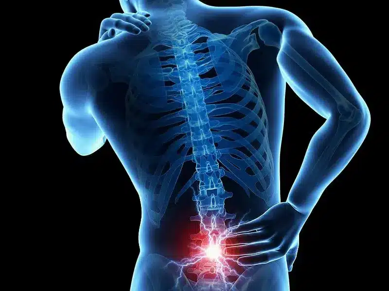 X-ray illustration of lower-back (lumbar) pain from a car accident injury